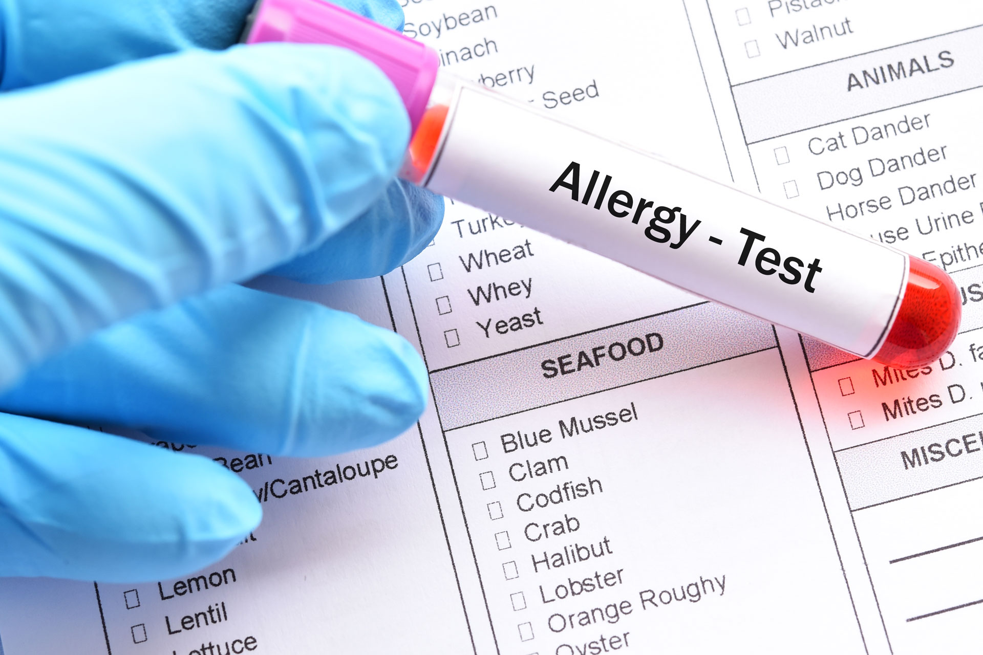 Kansas City Allergy & Asthma - Testing